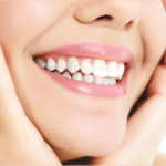 Top Smile Enhancement Treatments Available Today